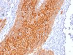 Cytokeratin, pan Antibody in Immunohistochemistry (Paraffin) (IHC (P))