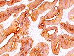 Cytokeratin, Multi Antibody in Immunohistochemistry (Paraffin) (IHC (P))