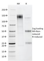 Helicobacter pylori Antibody in SDS-PAGE (SDS-PAGE)