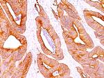 Cytokeratin, pan (Epithelial Marker) Antibody in Immunohistochemistry (Paraffin) (IHC (P))