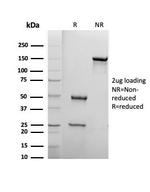 Biotin (Vitamin B7 or Vitamin H) Antibody in SDS-PAGE (SDS-PAGE)