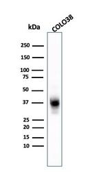 Melanoma Marker (MART-1 + Tyrosinase + gp100) Antibody in Western Blot (WB)