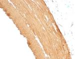 Actin, Muscle Specific (Muscle Cell Marker) Antibody in Immunohistochemistry (Paraffin) (IHC (P))