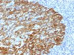 Cytokeratin, Basic (Type II or HMW) Antibody in Immunohistochemistry (Paraffin) (IHC (P))