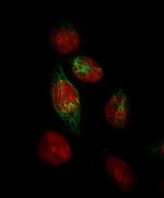 Cytokeratin, Basic (Type II or HMW) Antibody in Immunocytochemistry (ICC/IF)