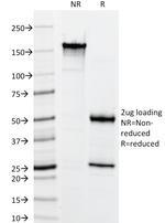 Cytokeratin, Basic (Type II or HMW) Antibody in SDS-PAGE (SDS-PAGE)