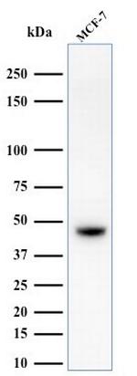 Cytokeratin, Basic (Type II or HMW) Antibody in Western Blot (WB)