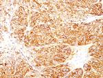 Melanoma Marker (MART-1 + gp100) Antibody in Immunohistochemistry (Paraffin) (IHC (P))