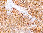 Melanoma Marker (MART-1 + gp100) Antibody in Immunohistochemistry (Paraffin) (IHC (P))