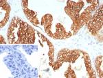 Cytokeratin 5/6 (Basal, Myoepithelial and Mesothelial Cell Marker) Antibody in Immunohistochemistry (Paraffin) (IHC (P))