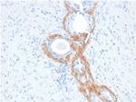 Cytokeratin, Basic (Type II or HMW) Antibody in Immunohistochemistry (Paraffin) (IHC (P))