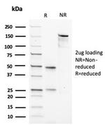 Actin, Muscle Specific (Muscle Cell Marker) Antibody in SDS-PAGE (SDS-PAGE)