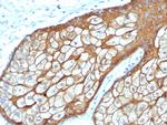 Cytokeratin, Type II (Epithelial Marker) Antibody in Immunohistochemistry (Paraffin) (IHC (P))