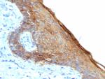 Cytokeratin, Type II (Epithelial Marker) Antibody in Immunohistochemistry (Paraffin) (IHC (P))