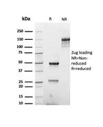 Cytokeratin, Type II (Epithelial Marker) Antibody in SDS-PAGE (SDS-PAGE)