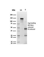 Cytokeratin, pan (Epithelial Marker) Antibody in SDS-PAGE (SDS-PAGE)