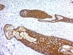 Cytokeratin, Basic (Type II or HMW) Antibody in Immunohistochemistry (Paraffin) (IHC (P))