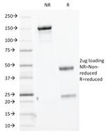 Cytokeratin, Basic (Type II or HMW) Antibody in SDS-PAGE (SDS-PAGE)