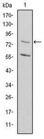 MTHFR Antibody in Western Blot (WB)