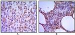 MUM1 Antibody in Immunohistochemistry (Paraffin) (IHC (P))