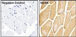 MUSK Antibody in Immunohistochemistry (Paraffin) (IHC (P))