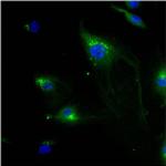 IGF2R Antibody in Immunocytochemistry (ICC/IF)