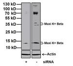 KCNMB1 Antibody