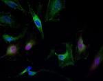 Myc Tag Antibody in Immunocytochemistry (ICC/IF)