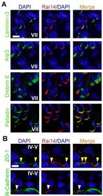 ZO-1 Antibody in Immunohistochemistry (IHC)