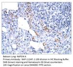 NAPSIN A Antibody in Immunohistochemistry (IHC)