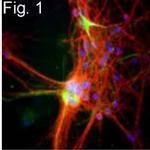 NF-H Antibody in Immunocytochemistry (ICC/IF)