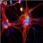 NEFL Antibody in Immunocytochemistry (ICC/IF)