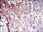 NEFL Antibody in Immunohistochemistry (Paraffin) (IHC (P))