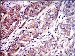 NEFL Antibody in Immunohistochemistry (Paraffin) (IHC (P))