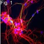 NEFM Antibody in Immunohistochemistry (IHC)