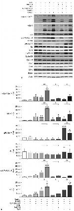 MDM2 Antibody in Western Blot (WB)