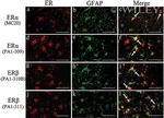 Estrogen Receptor beta Antibody in Immunohistochemistry (IHC)