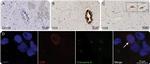 CD8 Antibody in Immunocytochemistry, Immunohistochemistry (ICC/IF, IHC)