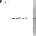 NF1 Antibody in Western Blot (WB)