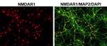 NMDAR1 Antibody in Immunocytochemistry (ICC/IF)