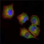 NME1 Antibody in Immunocytochemistry (ICC/IF)