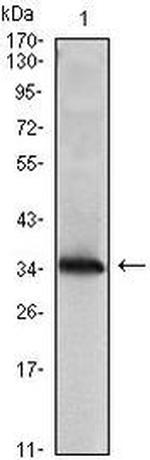 NME1 Antibody in Western Blot (WB)