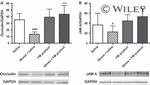 JAM-A (CD321) Antibody in Western Blot (WB)