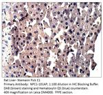 Niemann Pick C1 Antibody in Immunohistochemistry (IHC)