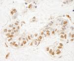 NSD1 Antibody in Immunohistochemistry (IHC)