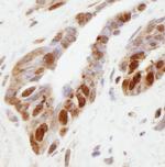 NSD1 Antibody in Immunohistochemistry (IHC)