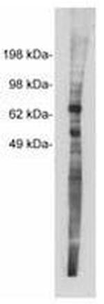 NTN1 Antibody in Western Blot (WB)