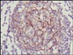 TrkC Antibody in Immunohistochemistry (Paraffin) (IHC (P))