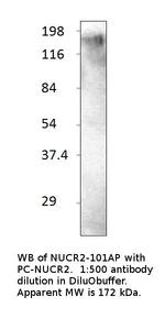 KAT13C/NCOA2 Antibody in Western Blot (WB)