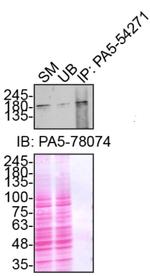 NEK1 Antibody in Immunoprecipitation (IP)